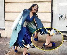 明星扭脚,康复之路引关注